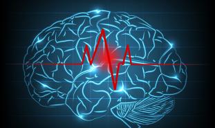 stroke brain image
