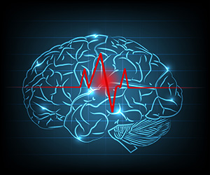 stroke brain image